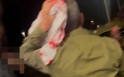 Nottingham Forest Sebut Pendukungnya Jadi Korban Penusukan Massal, Klub Janji Bantu Finasial